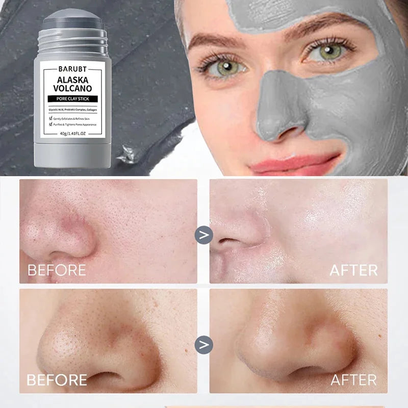 Alaska Mugwort Volcano Mask Stick – Pore & Acne Care 40g