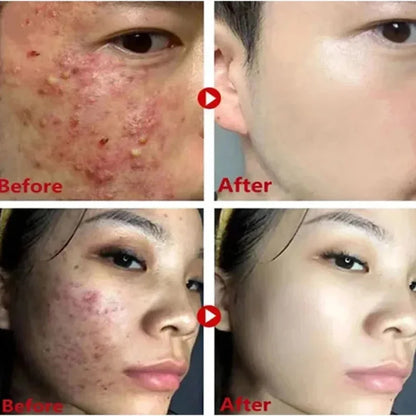 Alaska Mugwort Volcano Mask Stick – Pore & Acne Care 40g