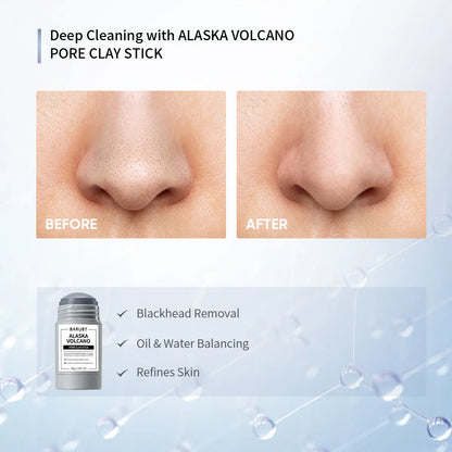 Alaska Mugwort Volcano Mask Stick – Pore & Acne Care 40g